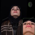 جراحی بینی ترمیمی در تهران