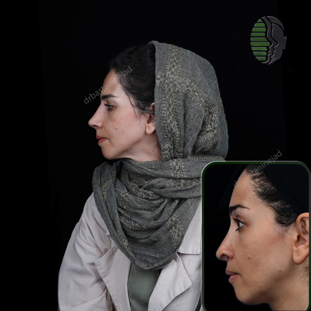 فااطمه بیگلری نیم رخ_ترمیم_ماه1-min