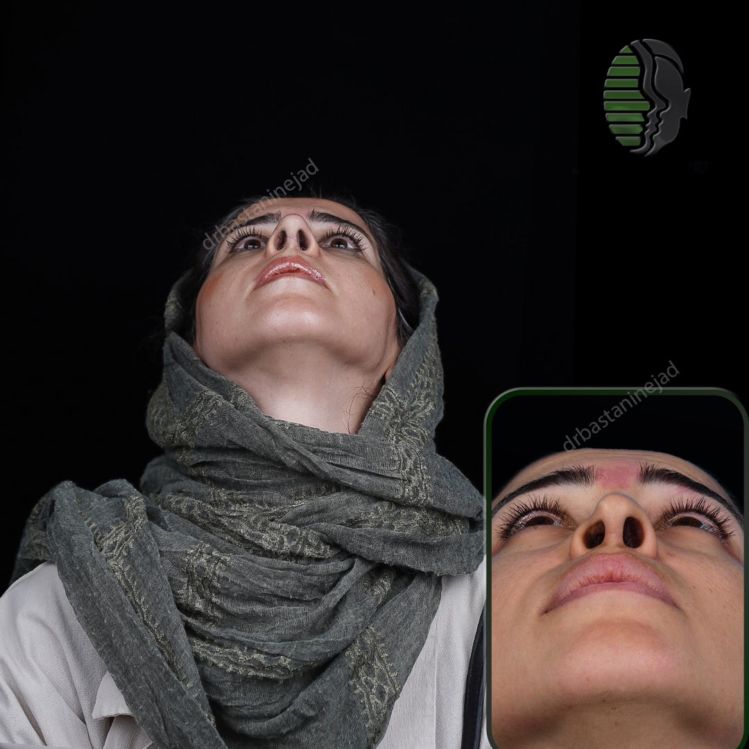 فااطمه بیگلری_base_ترمیم_ماه1-min