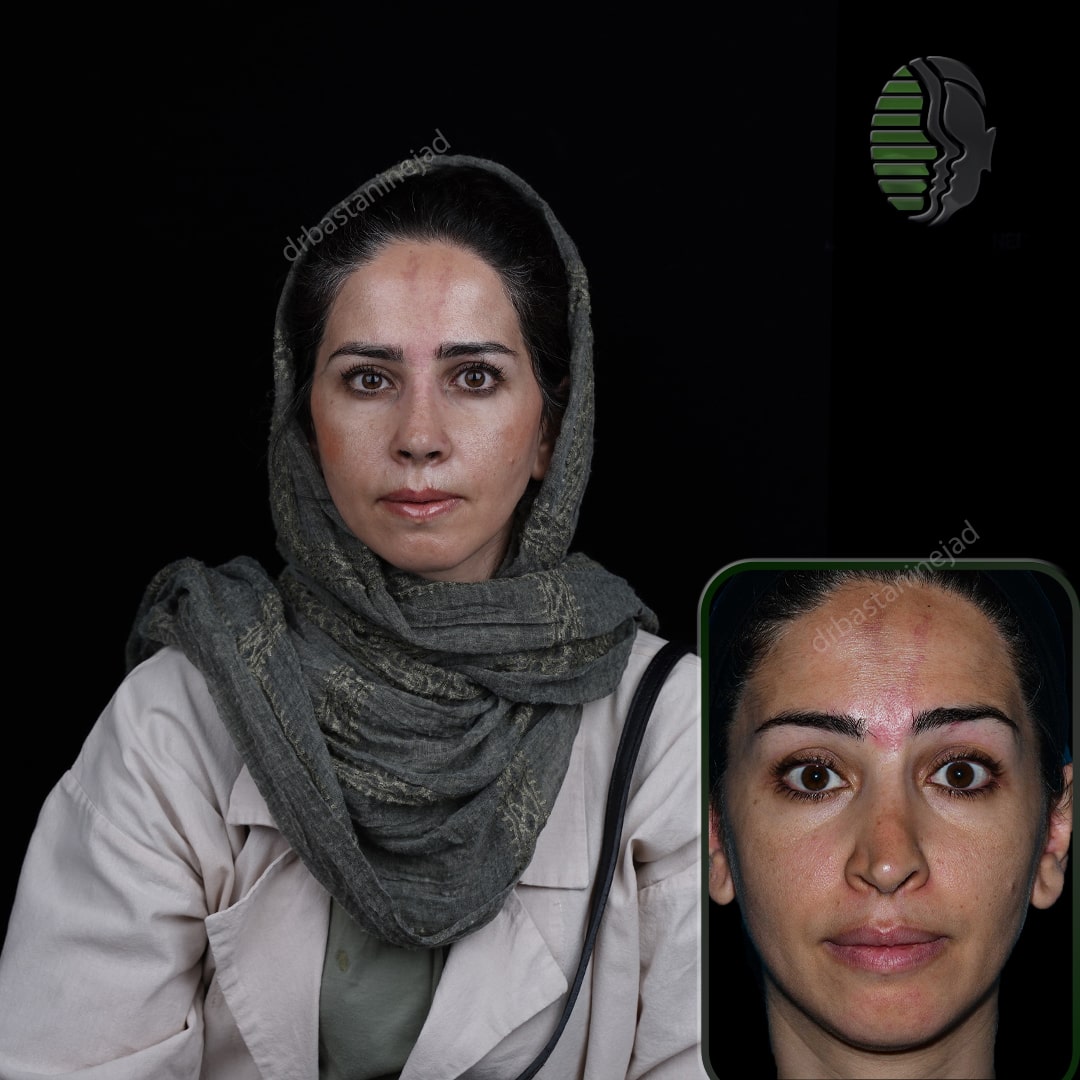 فااطمه بیگلری_تمام رخ_ترمیم_ماه1-min