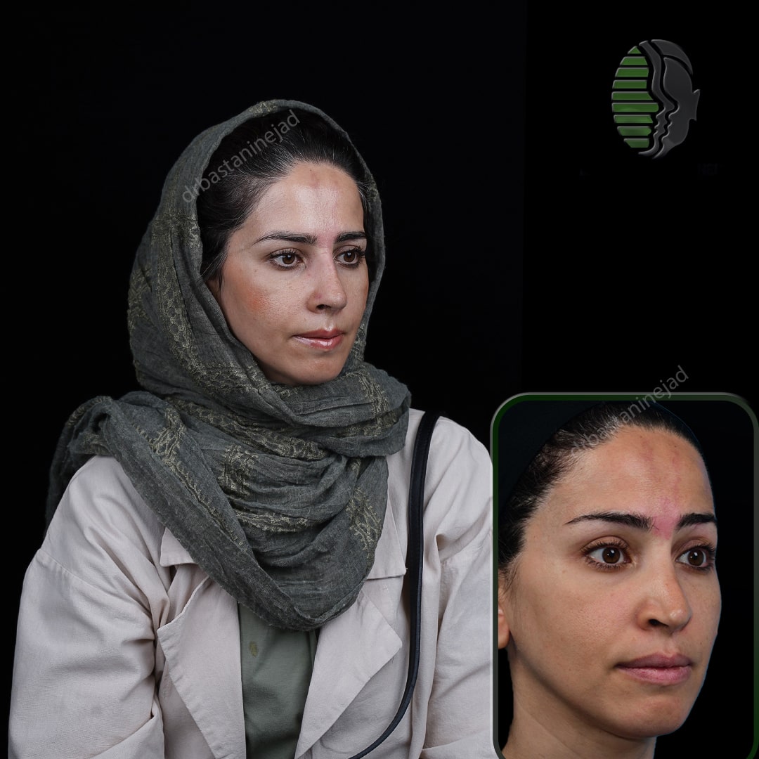 فاطمه بیگلری_ماه1_سه رخ1-min