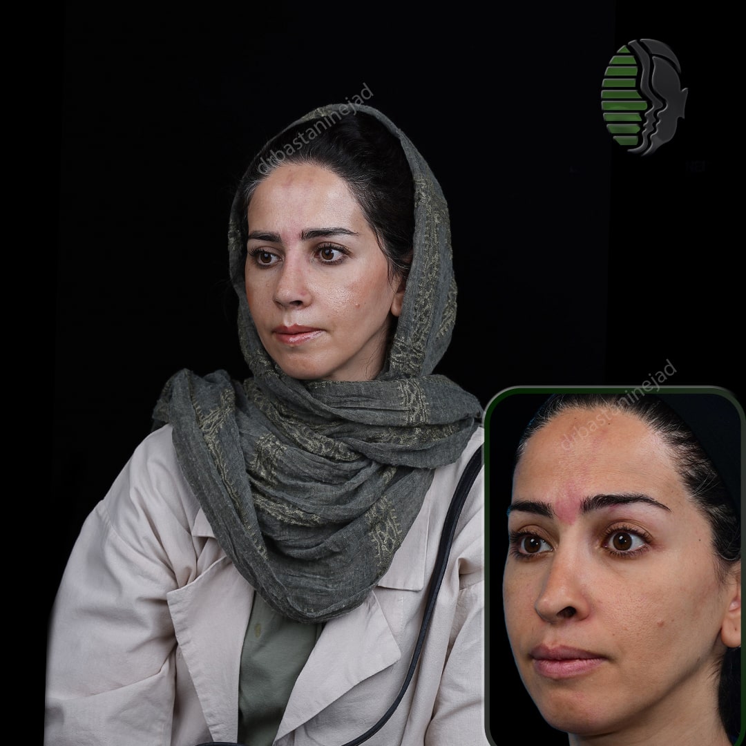 فاطمه بیگلری_ماه1_سه رخ2-min