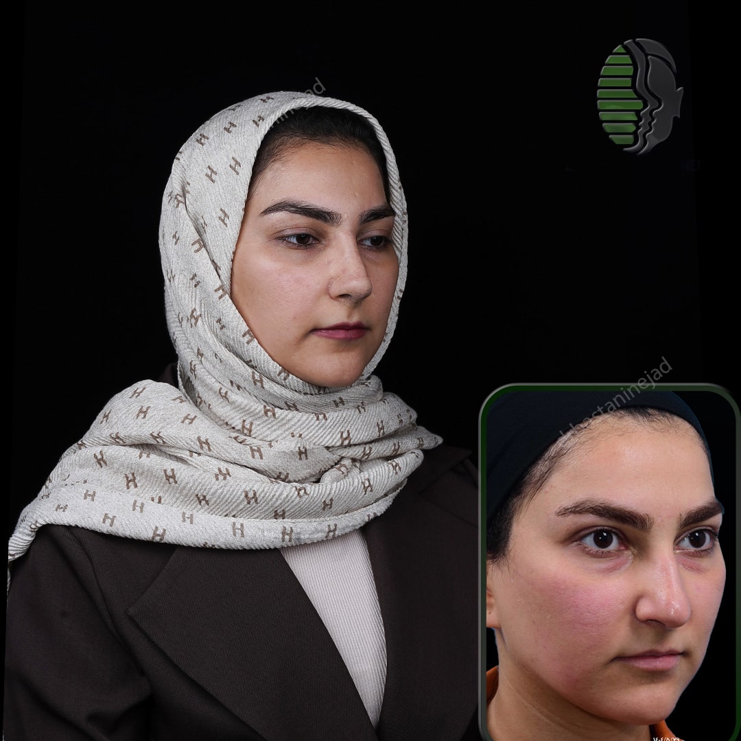 الهه سروشفر_ماه1_سه رخ1-min