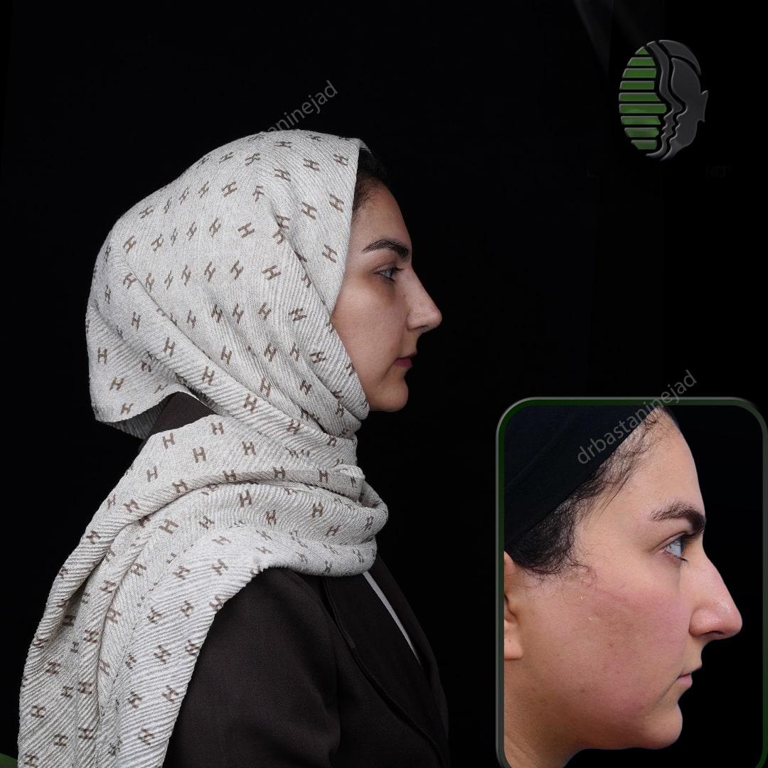 الهه سروشفر_ماه1_نیم رخ1-min