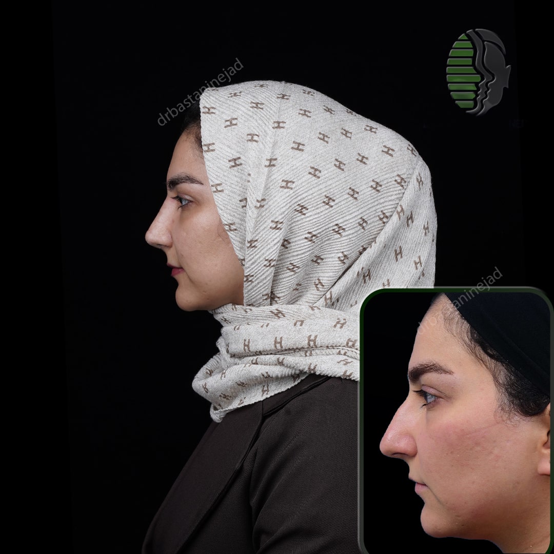 الهه سروشفر_ماه1_نیم رخ2-min