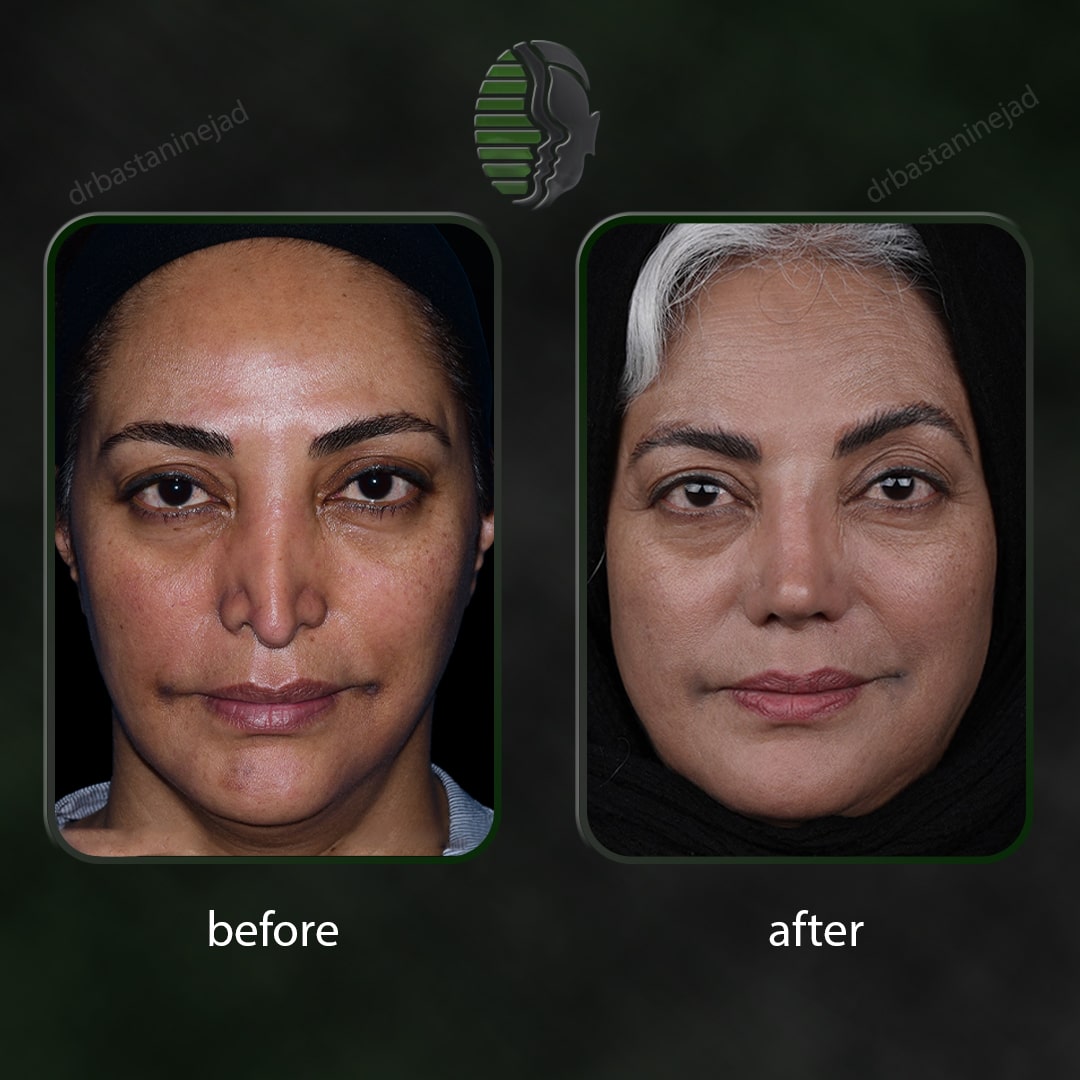 بتول شیخ شعاعی_رو به رو_سال3_ترمیم-min