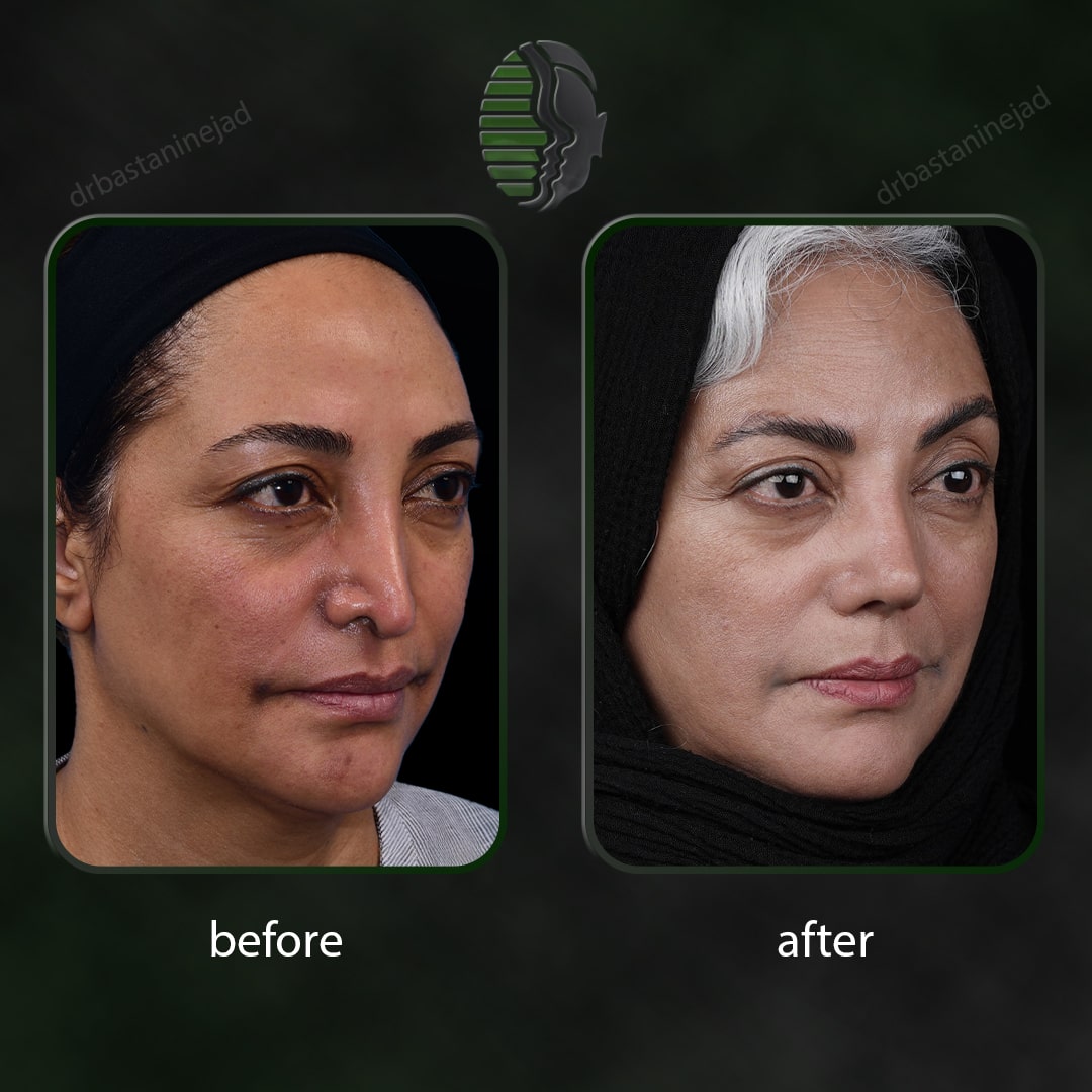 بتول شیخ شعاعی_سال3_ترمیم_سه رخ1-min