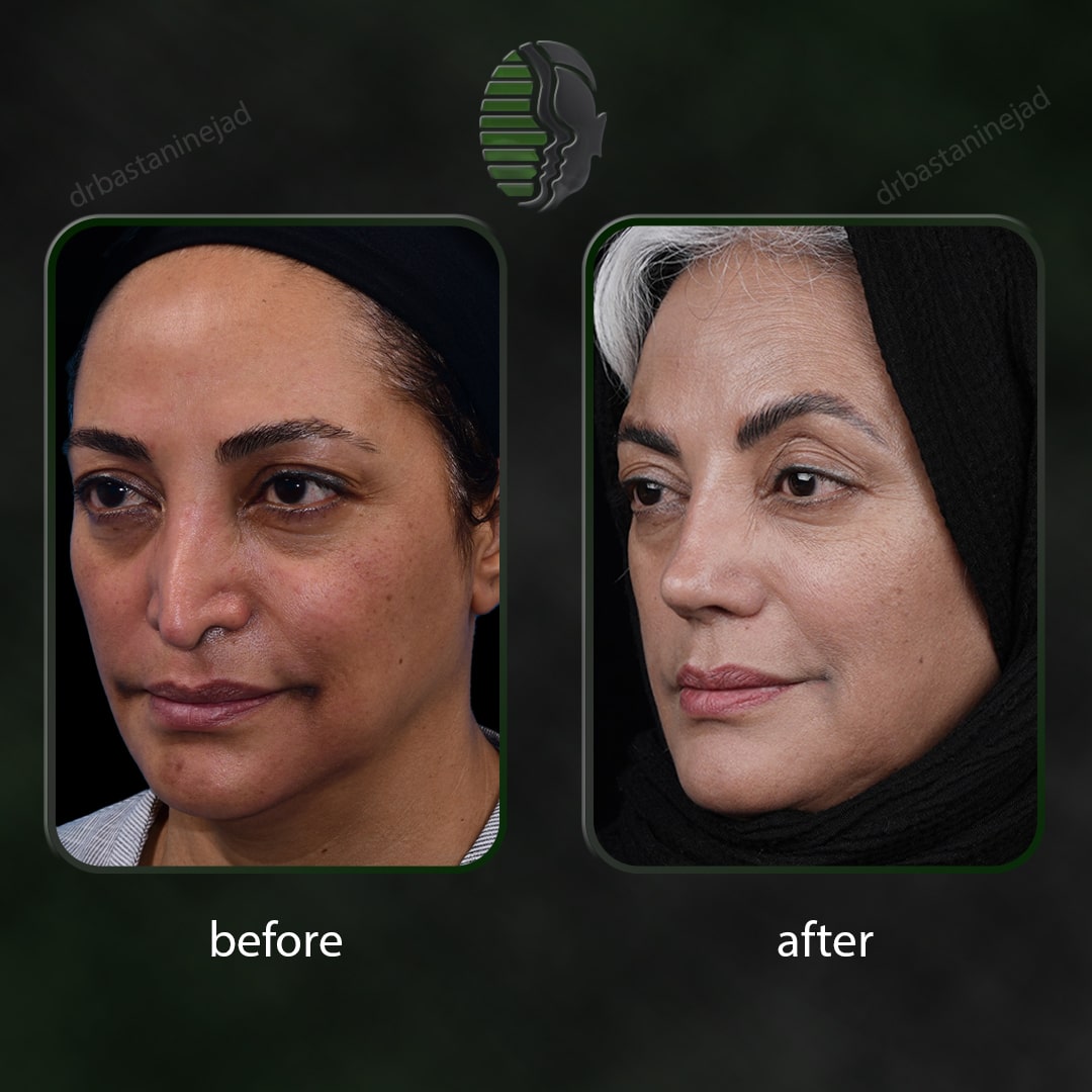 بتول شیخ شعاعی_سال3_ترمیم_سه رخ2-min