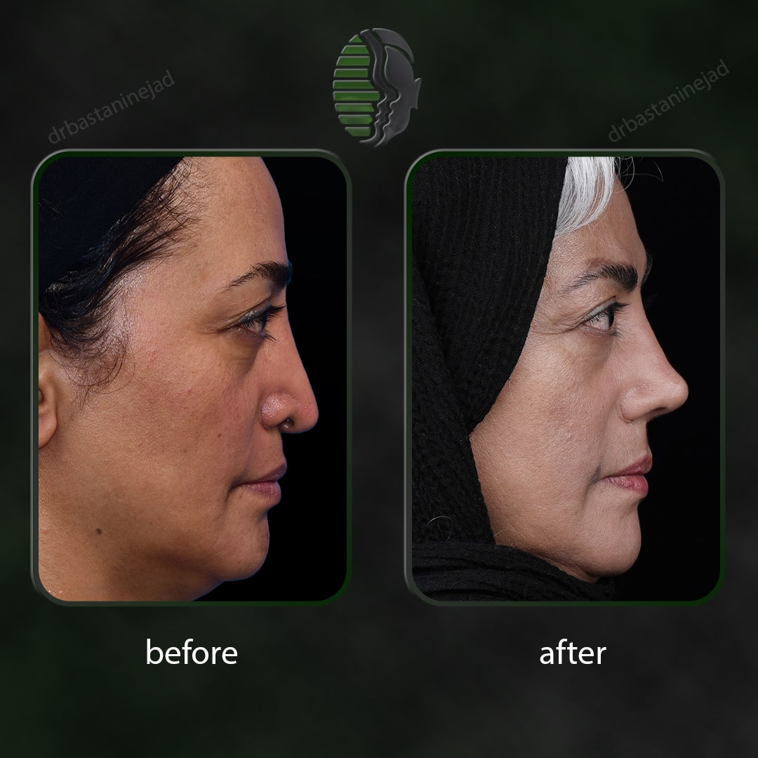 بتول شیخ شعاعی_نیم رخ_سال3_ترمیم-min