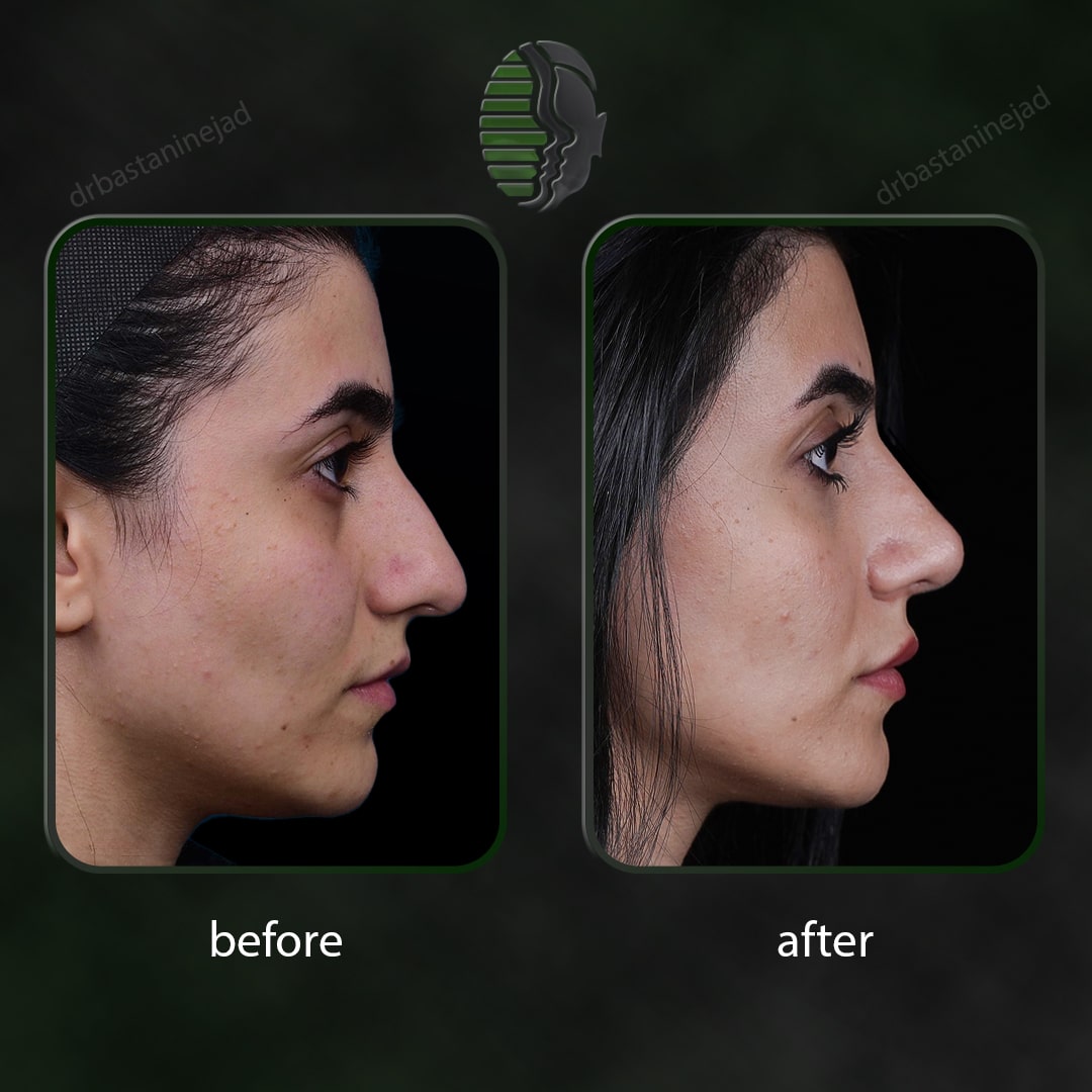 دنیا خاندان_نیم رخ1_سال 1 و نیم_-min