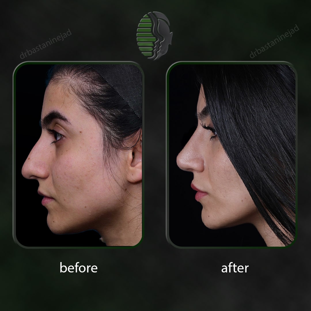 دنیا خاندان_نیم رخ2_سال 1 و نیم_-min