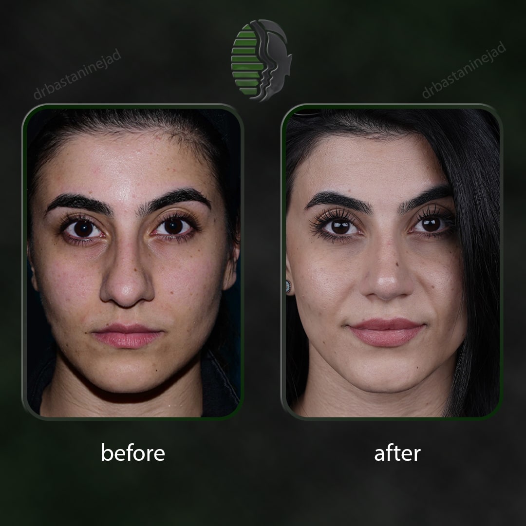 _رو به رو _دنیا خاندان_سال 1 و ماه4-min