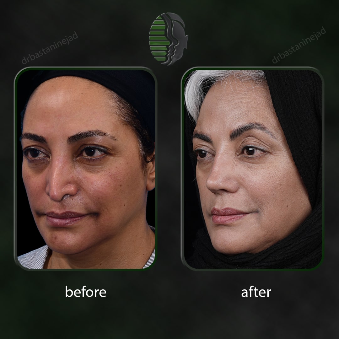 _سه رخ2بتول شیخ شعاعی_سال3_ترمیم-min