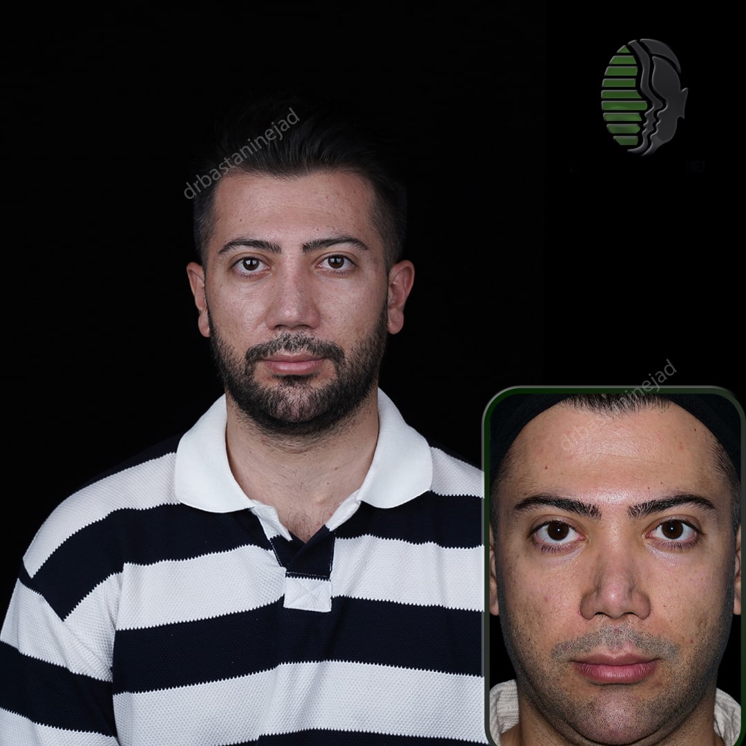 علی ساسانی_رو به رو_ماه1-min