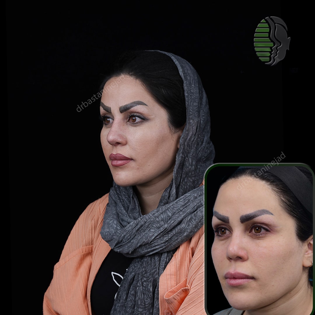 نغمه آقایی_سه رخ1_ماه1-min