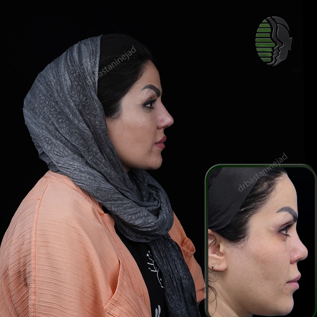 نغمه آقایی_نیم رخ 2_ماه1-min