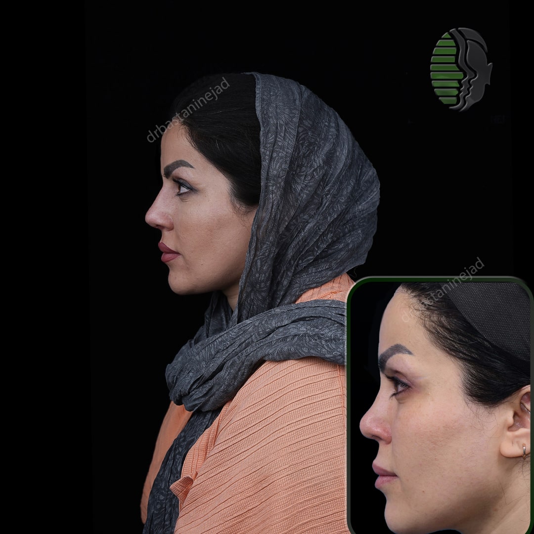 نغمه آقاییی نیم رخ1_ماه1-min