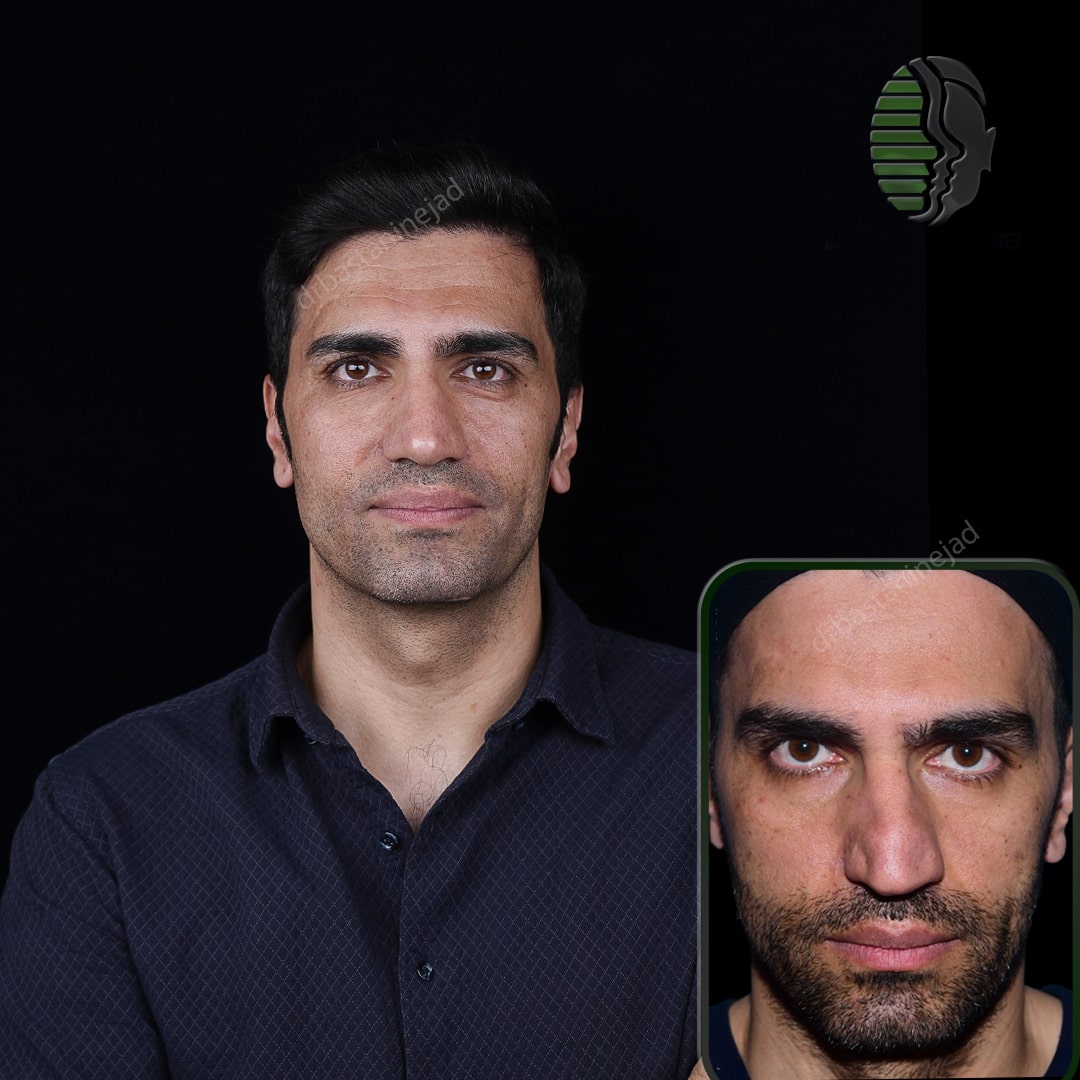 هادی رضایی_رو به رو2_سال 1 و نیم_-min