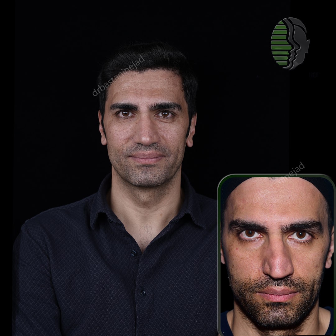 هادی رضایی_رو به رو_سال 1 و نیم_-min