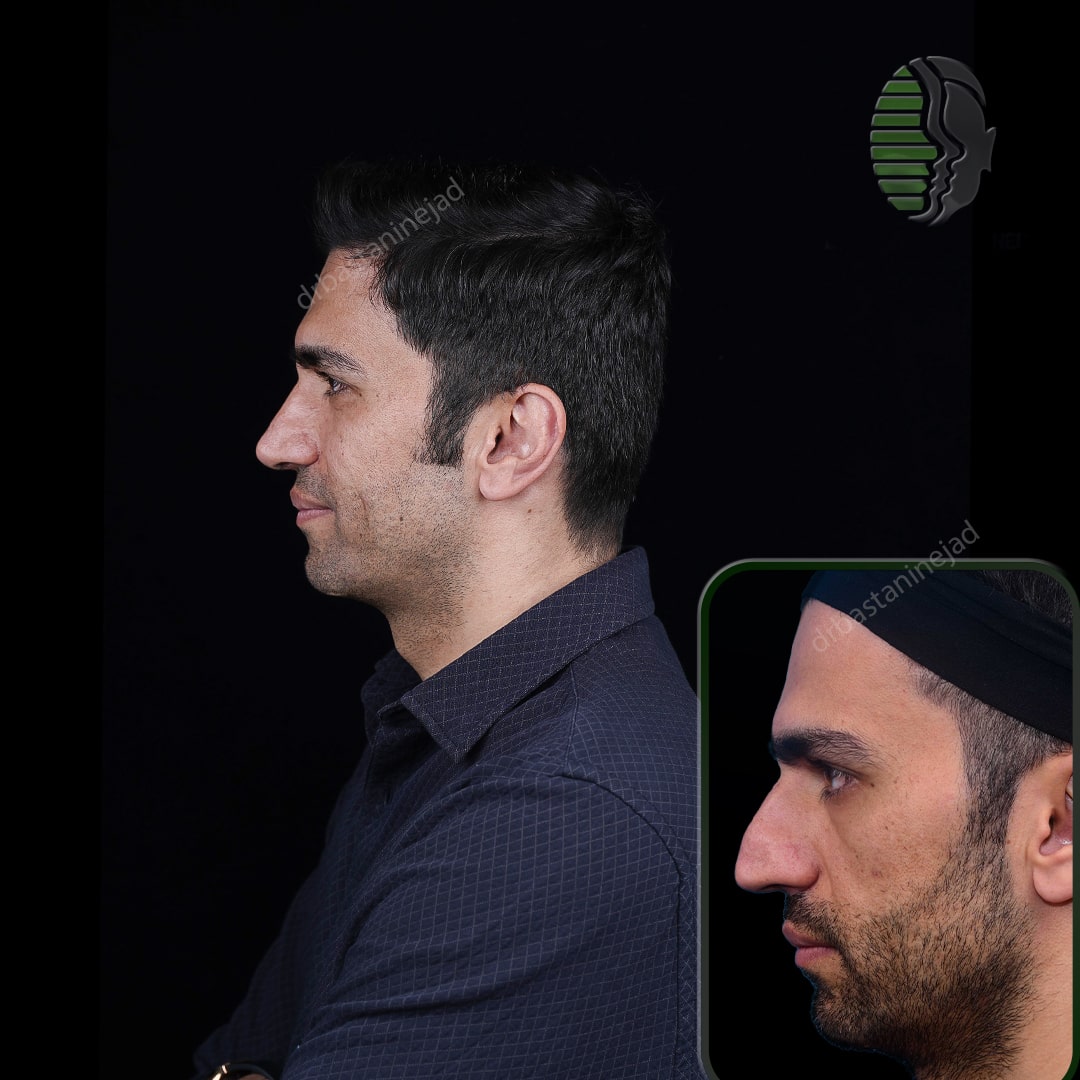 هادی رضایی_نیم رخ1_سال 1 و نیم_-min