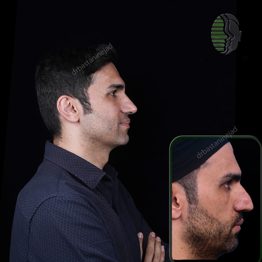 هادی رضایی_نیم رخ2_سال 1 و نیم_-min