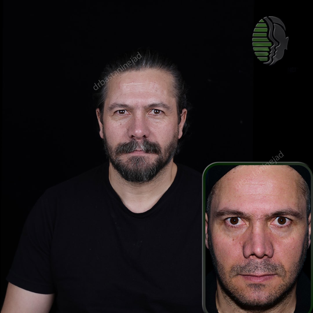 IMG_20251103_220141_445-min