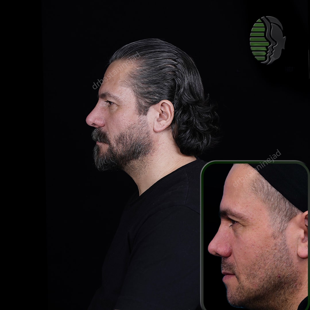 IMG_20251103_220141_802-min