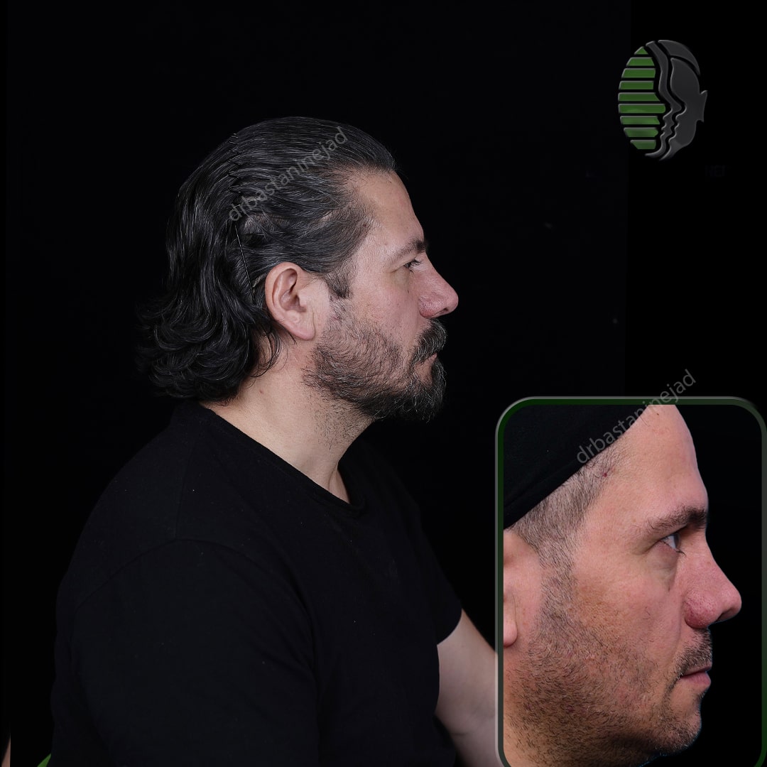 IMG_20251103_220141_965-min