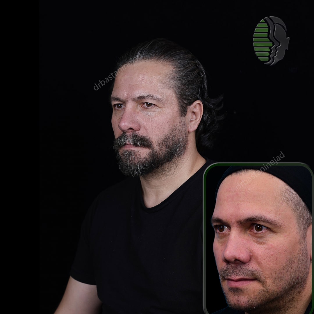 IMG_20251103_220142_167-min