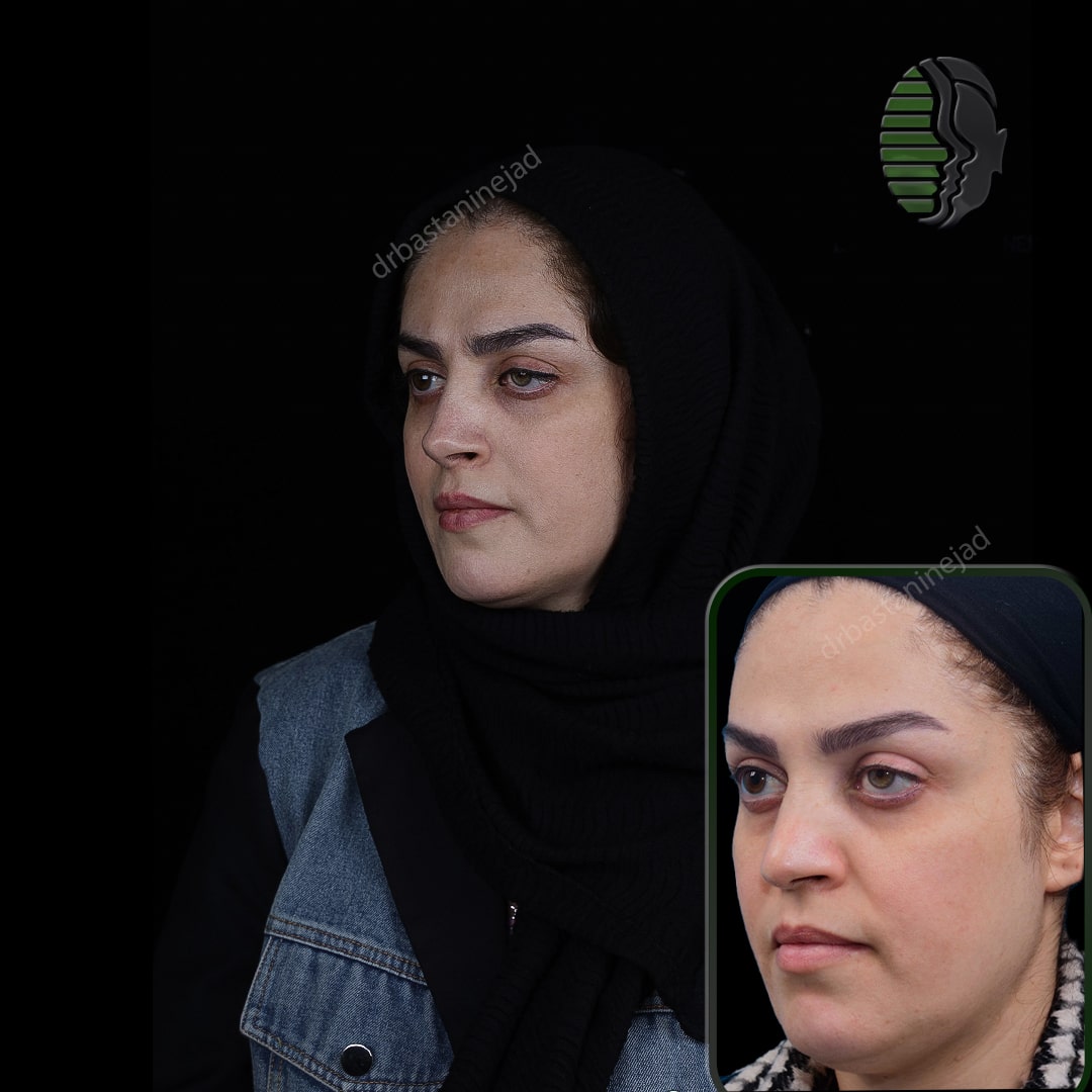 IMG_20251103_220148_599-min