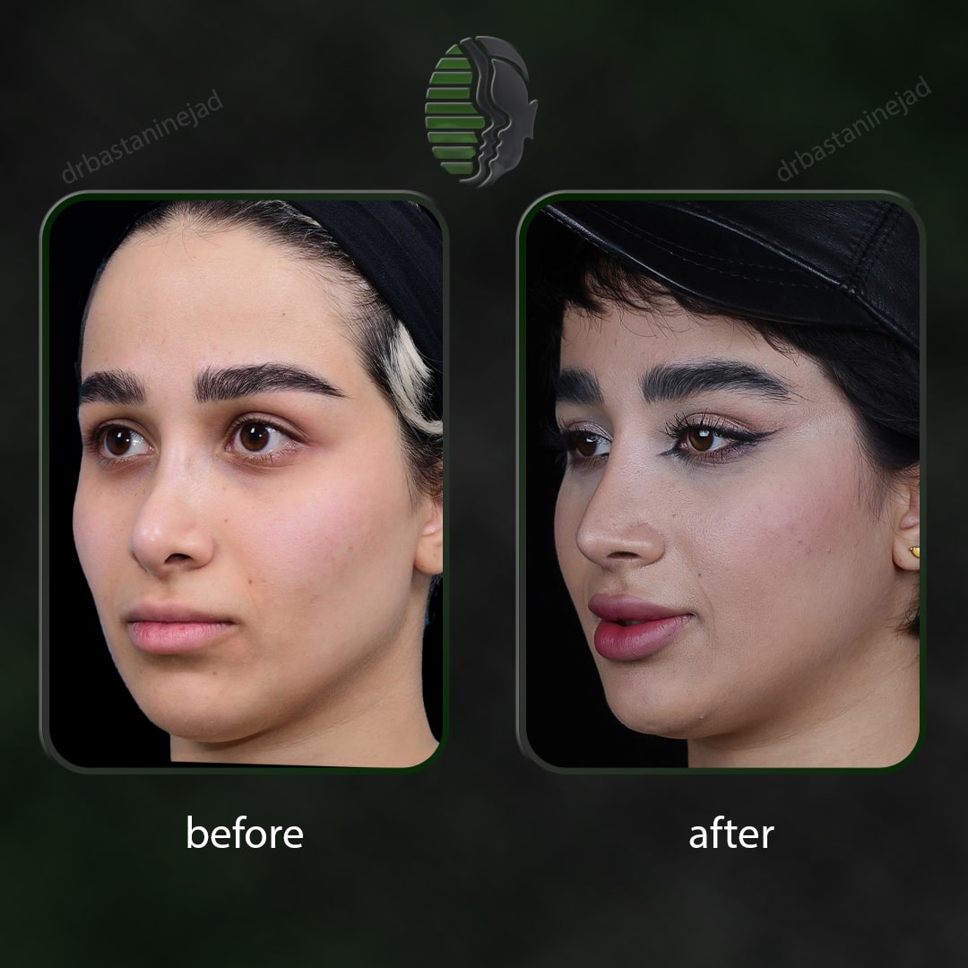 IMG_20251103_220148_835-min