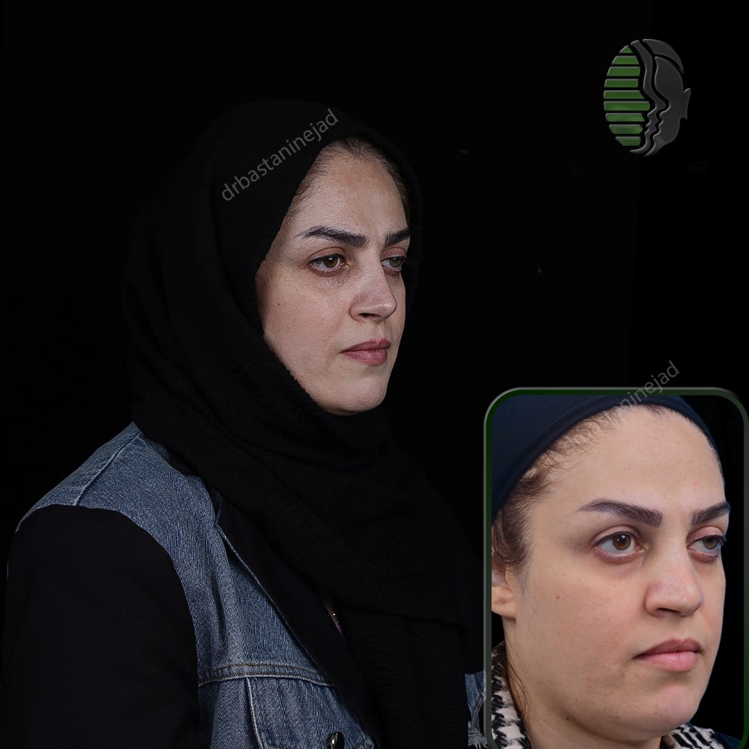 IMG_20251103_220148_847-min