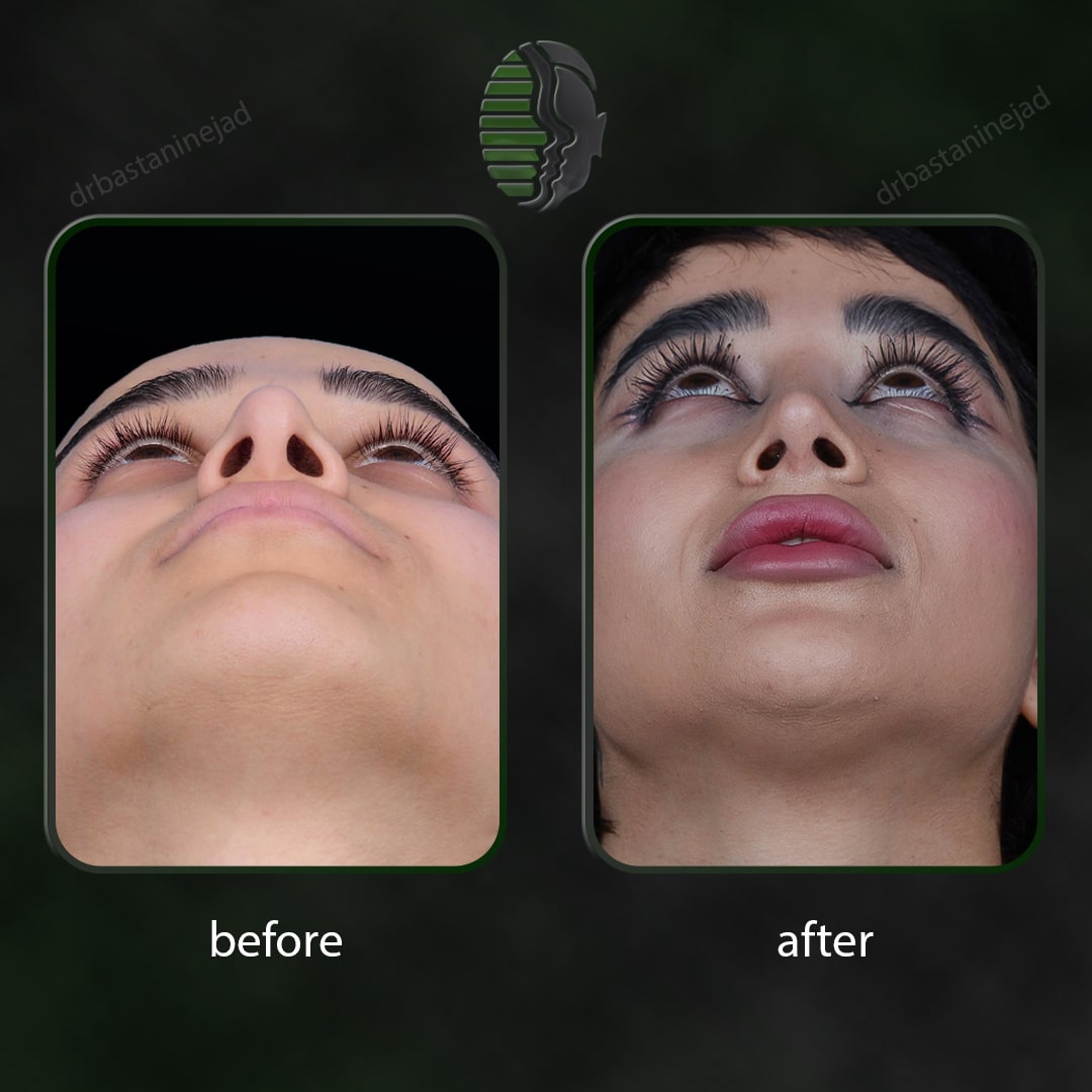 IMG_20251103_220148_940-min