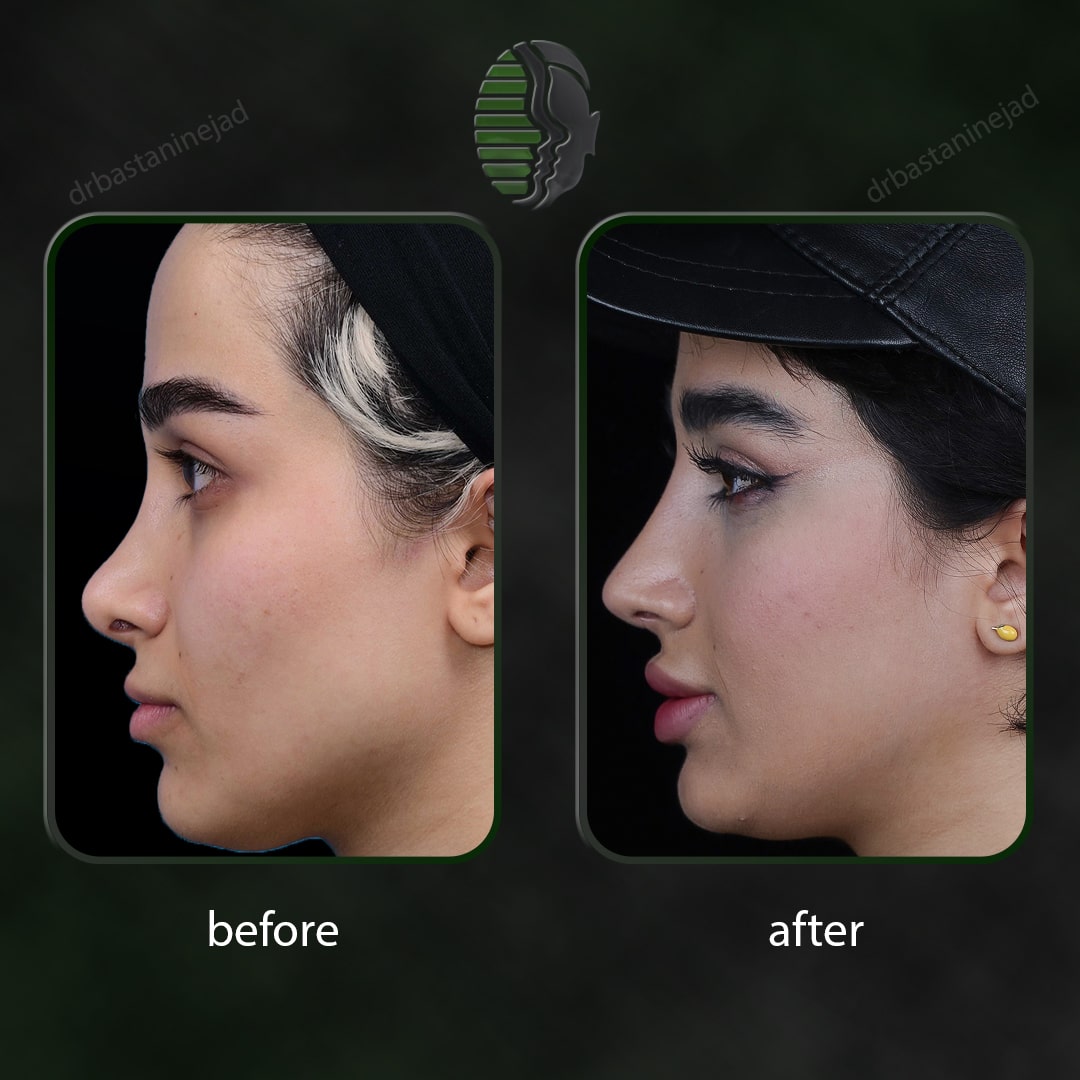 IMG_20251103_220149_033-min