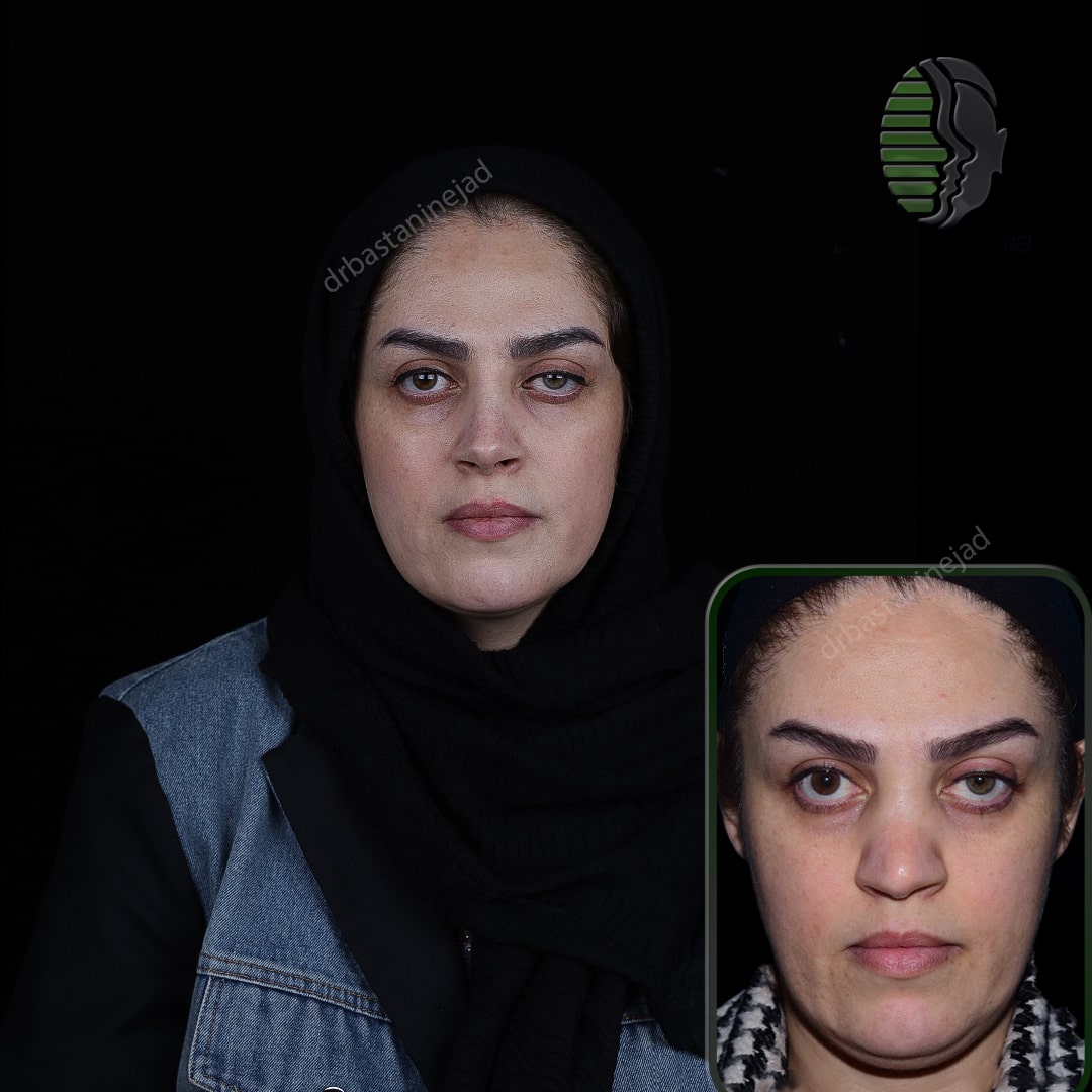 IMG_20251103_220149_087-min