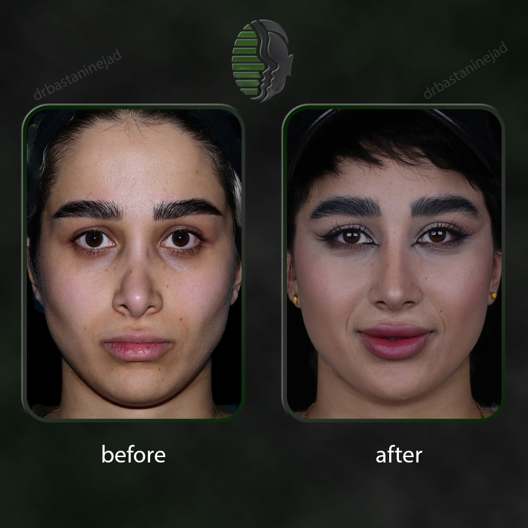 IMG_20251103_220149_120-min