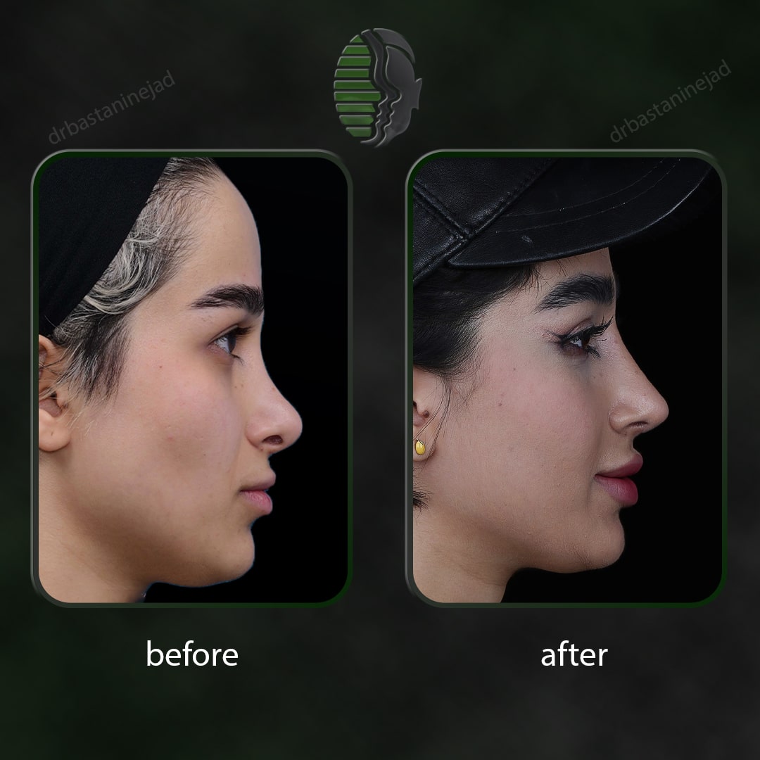 IMG_20251103_220149_200-min