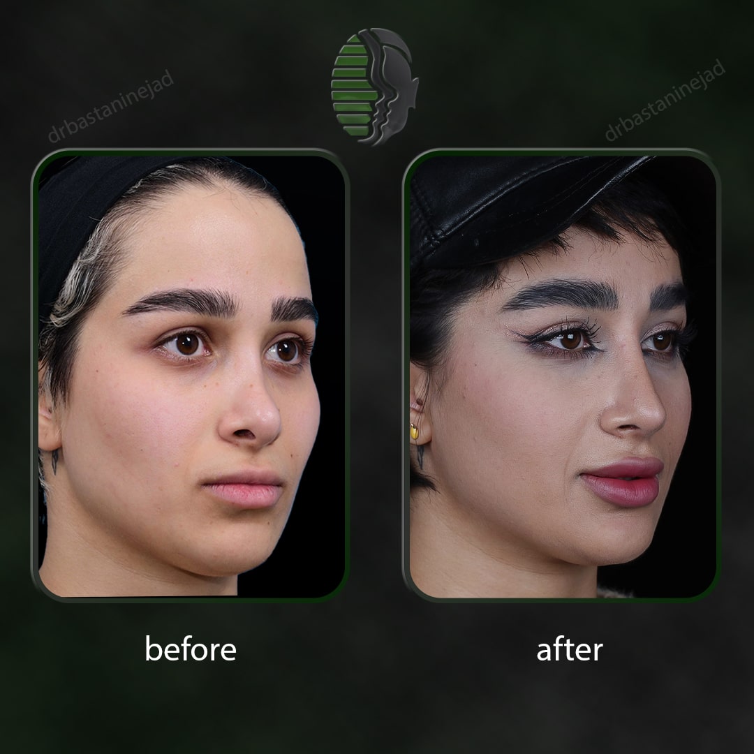 IMG_20251103_220149_311-min