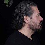 جراحی بینی مردانه در تهران