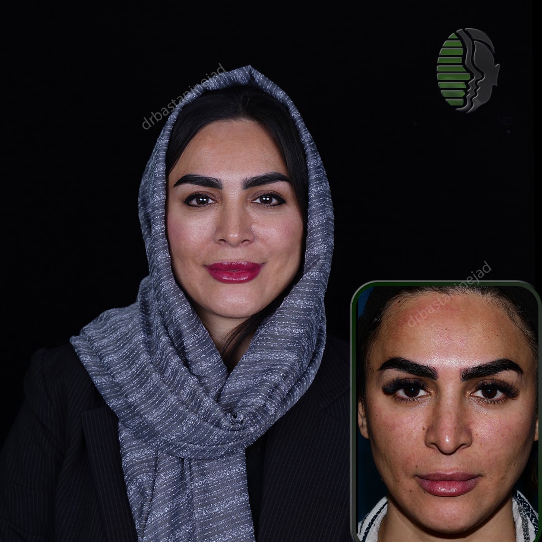 رقیه بشیری_رو به رو_سال1-min