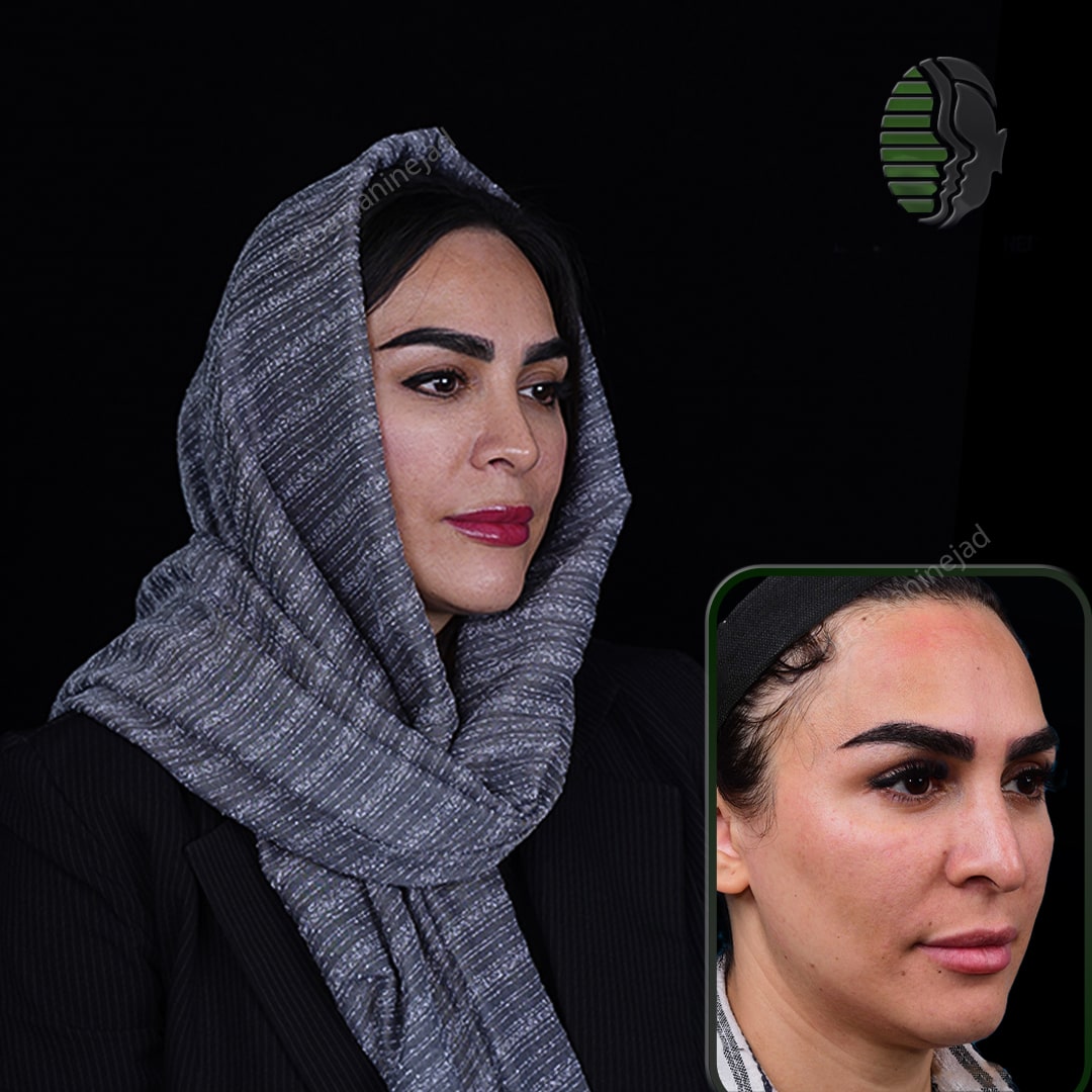 رقیه بشیری_سه رخ1_سال1-min