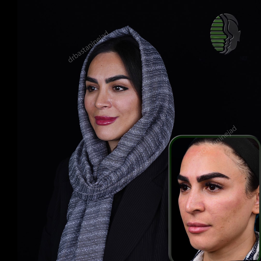 رقیه بشیری_سه رخ2_سال1-min