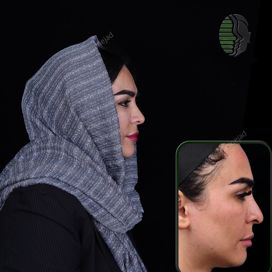 رقیه بشیری_نیم رخ1_سال1-min