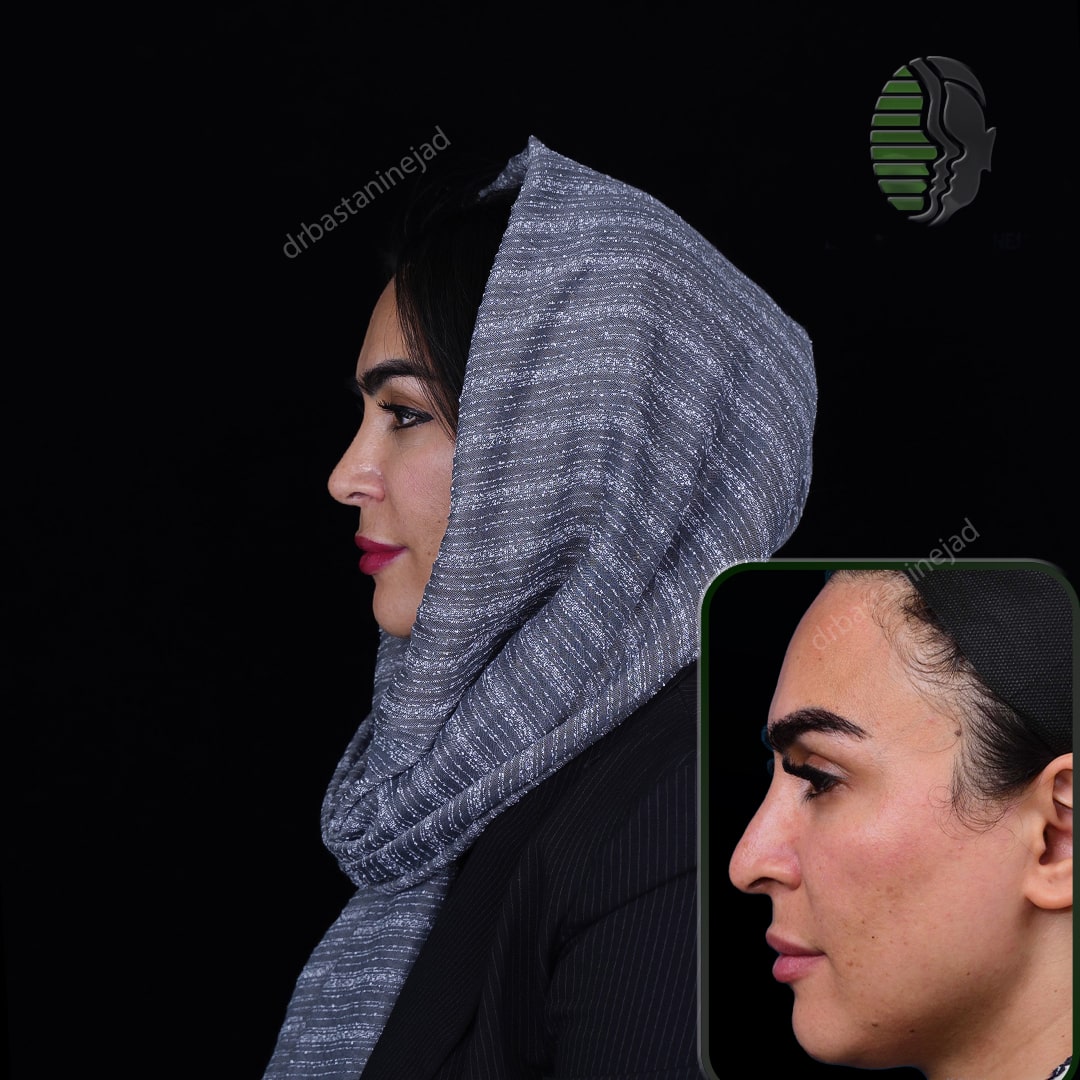 رقیه بشیری_نیم رخ2_سال1-min