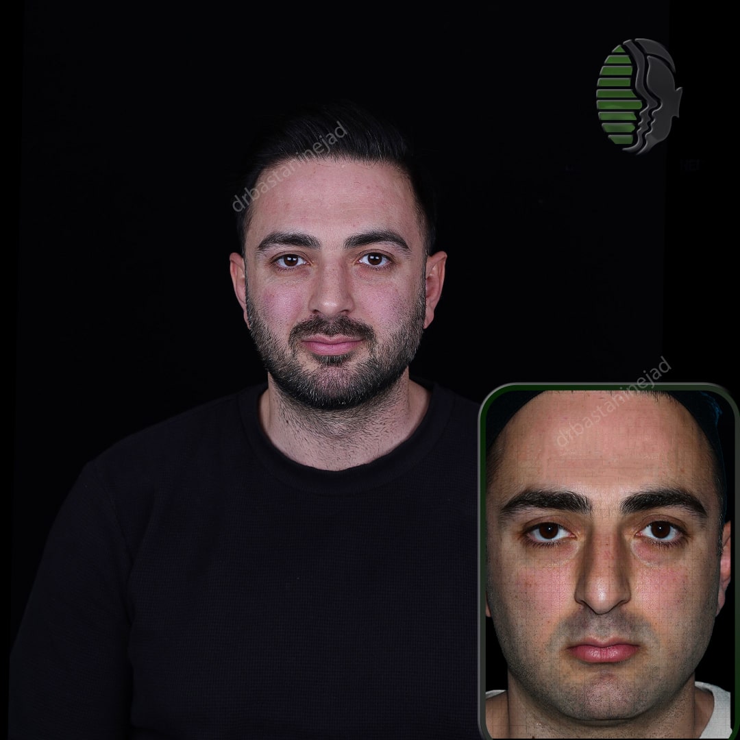 عرفا پناهی_ماه3_رو به رو-min