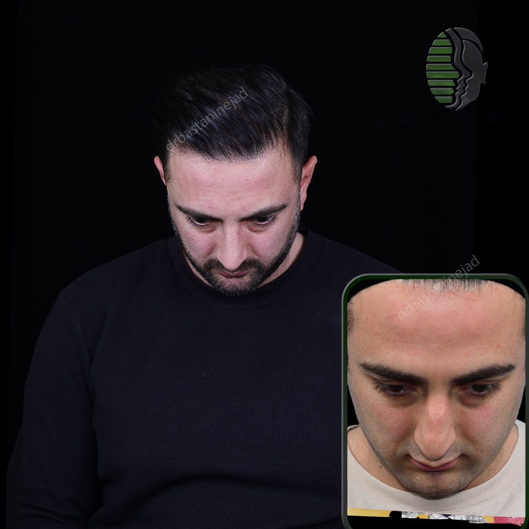 عرفان پناهی+ماه3_تیغه-min