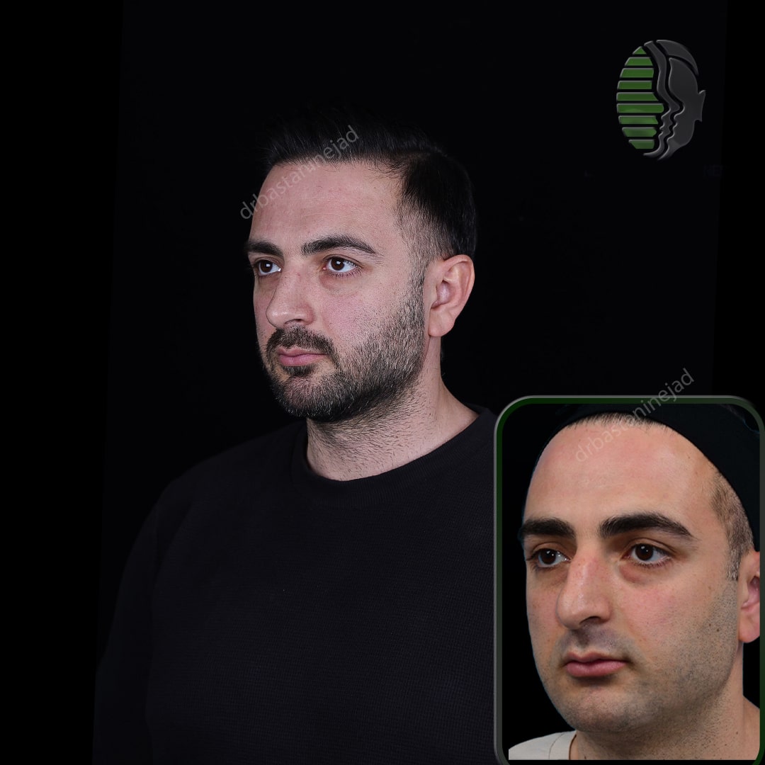 عرفان پناهی+ماه3_سه رخ2-min