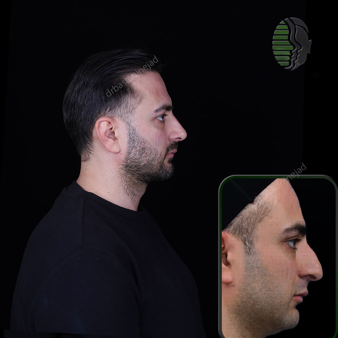 عرفان پناهی+ماه3_نیم رخ1-min