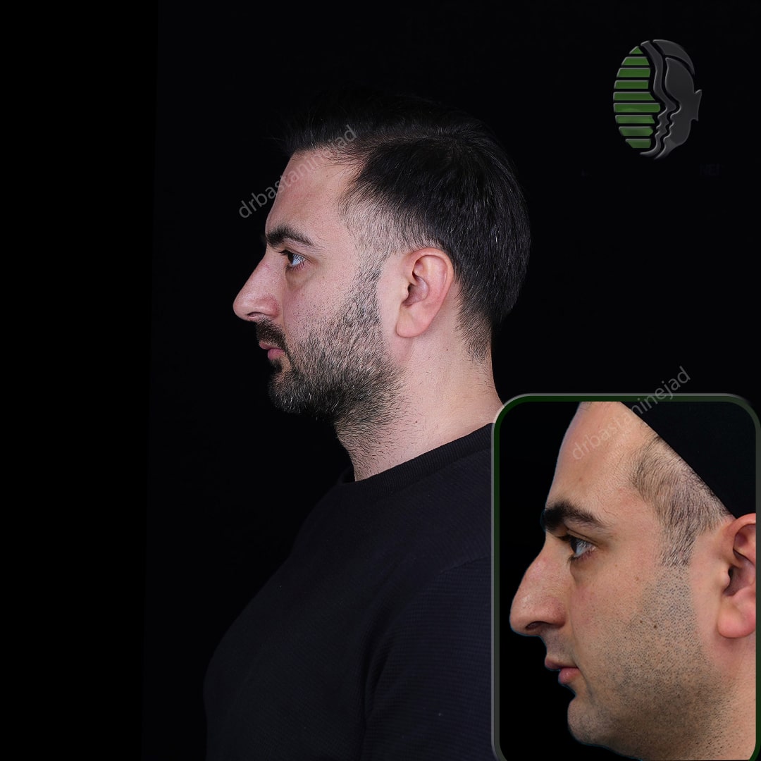 عرفان پناهی+ماه3_نیم رخ2-min