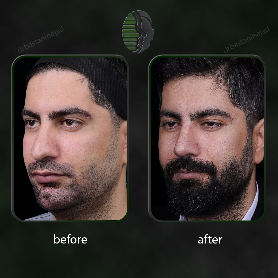 علی پاپی_ماه7_اولیه_سه رخ-min